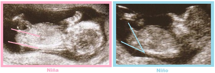 Cuando se puede saber el sexo del bebé niño o niña tuberculo genital