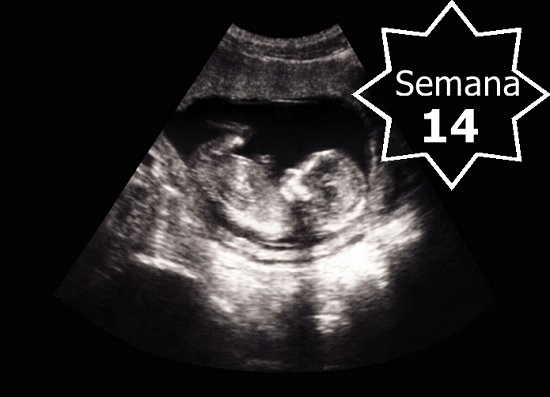 ecografia semana 14 de embarazo