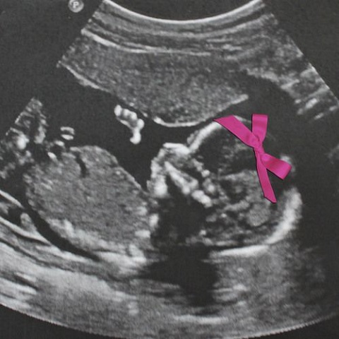 foto anunciar sexo bebé niño o niña