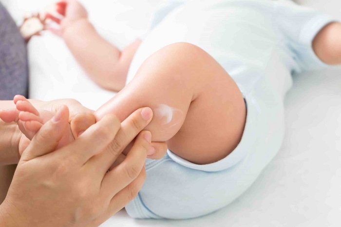 como usar crema para piel atopica como usar crema para piel atopica